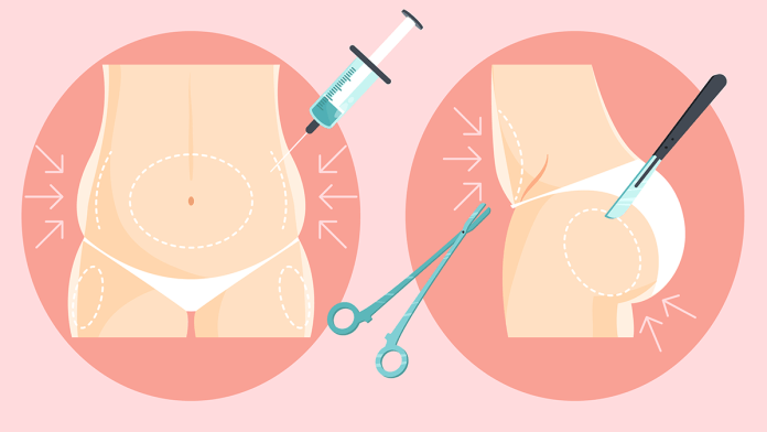 liposuction nasil yapilir ve riskleri nelerdir